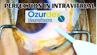 How to give intravitreal Ozurdex  Exercise right protocols from the beginning [upl. by Peednus]