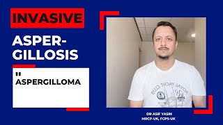 ASPERGILLOSIS  ASPERGILLOMA  Respiratory  ڈاکٹر آصف یاسین‬  mbbs NRE plab fmge [upl. by Zohar]