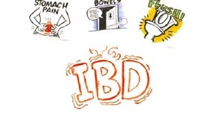 Inflammatory Bowel Disease IBD [upl. by Chalmers49]