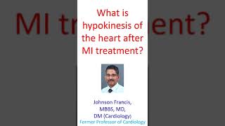 What is hypokinesis of the heart after MI treatment [upl. by Ennaillij]