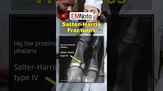 Salter Harris Fractures doctor medical trauma nursing [upl. by Lamrouex]