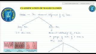 Orthodontics 3 Etiology of Malocclusion Classification of Malocclusion and Occlusion [upl. by Tedmann]