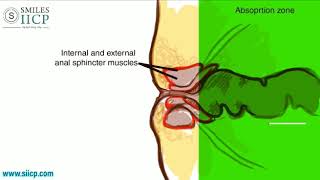 Learn How To Insert Anal Suppository  SMILES Gastroenterology [upl. by Ives899]