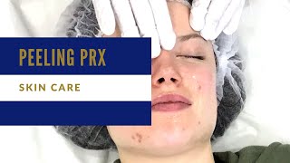 Peeling PRXT33 avec Claire [upl. by Tessie796]