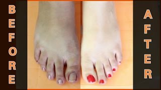 FEET WHITENING PEDICURE at home  Remove SUN TAN amp WHITEN YOUR SKIN [upl. by Asenab]