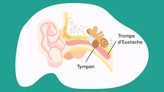 Bouchon d’oreille symptômes traitements et prévention [upl. by Einiar]