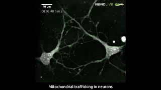 Visualizing mitochondrial trafficking in neurons [upl. by Yltsew508]