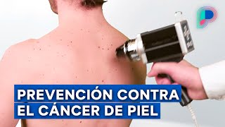 El mejor aliado para la prevención de cáncer de piel lo encuentras en Hospital CIMA [upl. by Nylarej66]