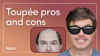 Hair Loss Solutions Explained The Toupee [upl. by Bitthia586]