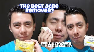 DermAid ACNE SOAP sa WATSONS Super Effective for PIMPLES [upl. by Eical]