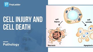 pathology  extracellular deposition calcification  lec6 part3 [upl. by Reginauld465]