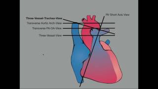 Advanced Evaluation of the Fetal Heart [upl. by Docila]