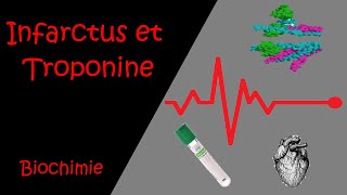 Infarctus et Troponine [upl. by Kay]