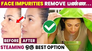 Benefits of Steaming Face  Glowing Skin at Home 😍 [upl. by Annahsirhc]