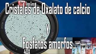 Cristales de oxalato de calcio monohidratado y Uratos amorfos  Uroanalisis [upl. by Nylinej]