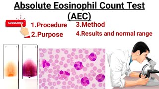 Absolute Eosinophils count ll AEC count Eosinophilia  Eosinopenia [upl. by Elkin]