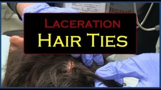 Laceration Hair Ties [upl. by Nigrom92]