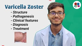 Chickenpox  Varicella zoster  Shingles  Human Herpes virus 6 7 8  Microbiology bangla lecture [upl. by Yousuf]