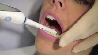 How to use an electric toothbrush  AJ Hedger [upl. by Ihcelek]