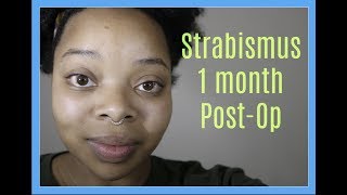 Strabismus Surgery Lazy Eye 1 Month PostOp [upl. by Nahej]