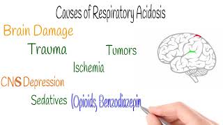 Respiratory Acidosis amp Alkalosis ABG Part 3 [upl. by Neitsirhc]