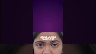 Demystifying Orbicularis Myokymia in 60 seconds Understand causes and discover treatment options [upl. by Huntington604]