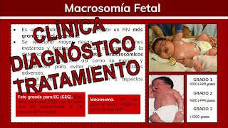 ⚕️🩺 Alteraciones del Crecimiento Fetal MACROSOMÍA FETAL  Ginecología [upl. by Esther]