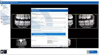 Training Apteryx XrayVision DCV Exporting Images [upl. by Sandye]