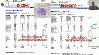 PSEUDOTROMBOCITOPENIA CONCEPTO [upl. by Aerdnat]