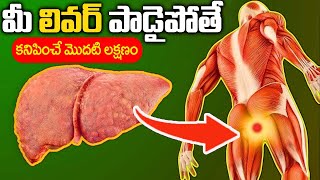 10 Symptoms of Liver Problem  Fatty Liver Symptoms  liver damage Sign  Dr Kavya  iD Health 360 [upl. by Elaweda]