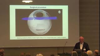 USH2018 Eberhart Zrenner Retina Implantat und Elektrostimulation [upl. by Gorey]