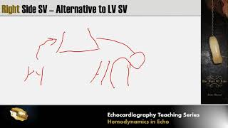 Lecture 8  Hemodynamics in Echocardiography [upl. by Twitt956]