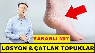 Losyon Neden Çatlamış Topukları ve Kuru Ayakları Asla Düzeltmez  DrBerg Türkçe [upl. by Aizek]