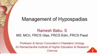 Hypospadias Management Lecture by Dr Ramesh Babu [upl. by Hayouqes]