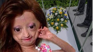 RIP Youtuber Adalia Rose Died Last Moment With her Mother😭This is so sd [upl. by Sheepshanks]