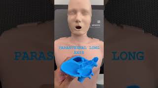 Parasternal long axis view orientation  POCUS  Dr Koratala shorts [upl. by Ayidah729]