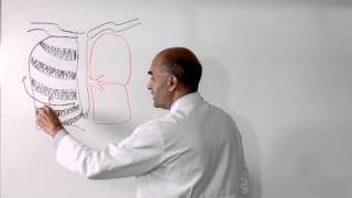 Lobectomy of Lung  How is it Performed [upl. by Daley]