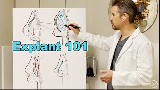 Explant 101 Breast Implant Removal Basic Concepts [upl. by Anaidni925]