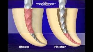 ProTaper® Canal Shaping with Dr Ruddle [upl. by Verdie]