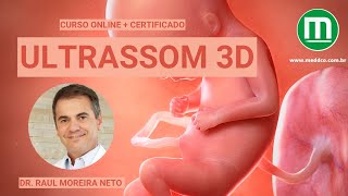 Curso de USG Ultrassonografia 3D [upl. by Merilyn566]