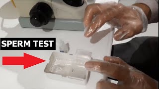 SPERM COUNT TEST  HOW IS IT PERFORMED [upl. by Audrit34]