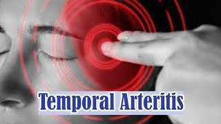 Temporal Arteritis  Giant Cell Arteritis  Symptoms Causes Complications and Treatment [upl. by Nekial668]