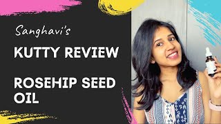 Rosehip Oil for Acne  Sanghavis Kutty Review  Tamil [upl. by Nowujalo978]