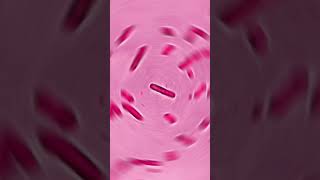 PSEUDOMONAS AUROGENOSA GRAM NEGATIVE BACILLI viral biology mlt viraltrend chemistrypathology [upl. by Laroy]