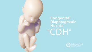 CDH Part 1 What is Congenital Diaphragmatic Hernia [upl. by Ellehcem419]