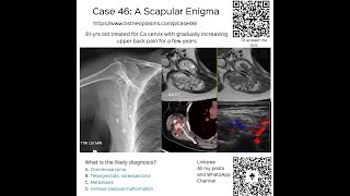 Case 46 A Scapular Enigma [upl. by Ursala]