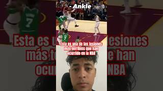 Lesiones deportivas Luxación y fractura de tobillo en jugador de NBA fisioterapia kinesiologia [upl. by Lucier]