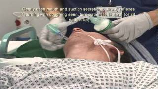 Intubation Extubation 67 [upl. by Raney114]