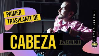 Primer trasplante de cabeza con exito  ¿Valery Spiridonov recibió el transplante  PARTE 2 [upl. by Leuqim]