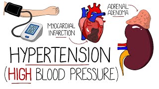 Hypertension Explained High Blood Pressure  Includes Hypertensive Emergency amp NICE Guidelines [upl. by Atnuahs]